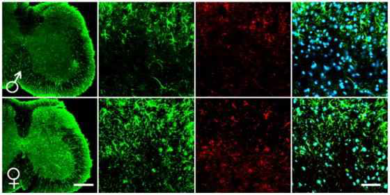 CCI 후 성별에 따른 별아교세포(GFAP,녹색) 및 pp38 (적색)의 발현 변화 차이