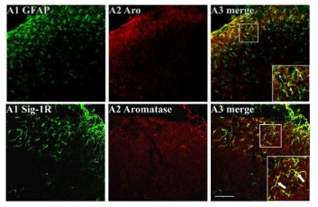 aromatase의 별아교세포 내 발현 및 시그마-1 수용체와 동일 세포 상 분포
