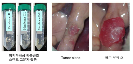항암제 자가 방출 피막 제작