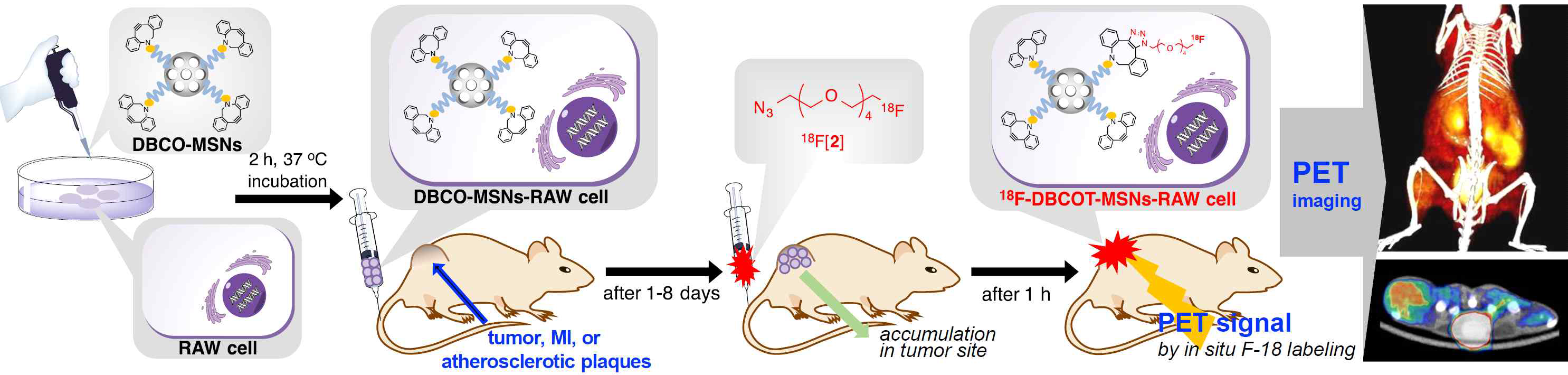 Schematic procedure for the in situ synthesis of 18F-DBCOT-MSNs into macrophage cells in a living specimen by a bioorthogonal 18F-labeling reaction for the cell tracking PET imaging