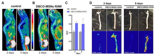 (A and B) Representative PET-CT images of atherosclerosis by macrophage cell tracking via in vivo F-18 labeling. Sagittal PET images of atherosclerosis in ApoE-/-mice on western diet for 30 weeks, given only RAW264.7 cell (control study; A) or DBCO-MSNs-RAW cells (cell tracking study; B) 2 or 5 days earlier, at 1h intravenous post-injection of [18F]2. Dotted circles indicate the [18F]2uptake in aorta, (C) their SUVs in aorta area. (D) Ex vivo autoradiography of the aortas from control group, or mice pre-injected with DBCO-MSNs-RAW cells 2 or 8 days earlier at 1 h intravenous post-injection of [18F]2