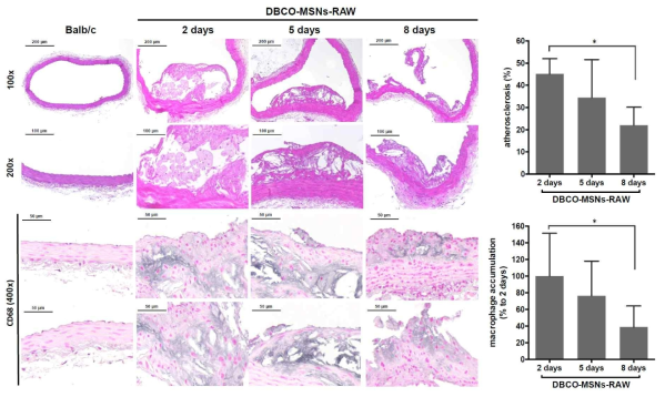 H & E staining (upper row) and CD68 immunostaining (lower row) analysis of aortic tissues in normal mice (Balb/c) and the ApoE-/-mice treated with the DBCO-MSNs-RAW cells 2, 5, or 8 days earlier