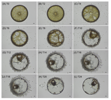 연구 정점 14에서 출현한 규조류 Coscinodiscus wailesii를 감염시킨 포식기생성 편모류 Pirsonia cf. diadema의 시간에 따른 감염양상의 변화