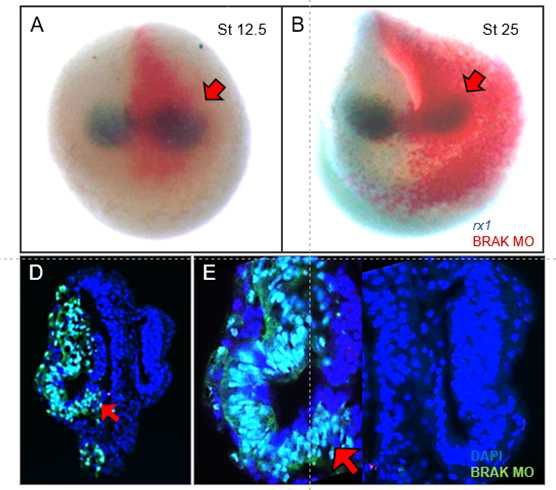 BRAK 수용체를 발현하는 세포의 기능이상 연구 (In situ hybridization)