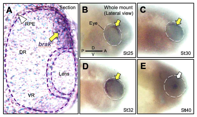 BRAK 발현 연구(In situ hybridization)