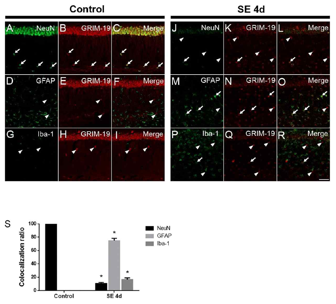 정상군(Control)과 뇌전증중첩증(status epilepticus, SE) 동물모델의 해마에서 GRIM-19과 신경세포 표지자인 NeuN(A-C, J-L), 별아교세포 표지자인 GFAP(D-F, M-O) 또는 미세아교세포 표지자인 Iba1(G-I, P-R)를 이용한 이중 면역형광염색 사진. 방사층(stratum radiatum)에서 GRIM-19-발현 세포 중 NeuN, GFAP 또는 Iba1-양성발현을 보인 세포의 비율(J), 화살 표시: GRIM-19과 NeuN, GFAP 또는 Iba1 이중염색세포. 화살촉: GRIM-19만을 발현하는 세포. scale bar=25 um. t-검정 분석, 모든값 평균±SEM