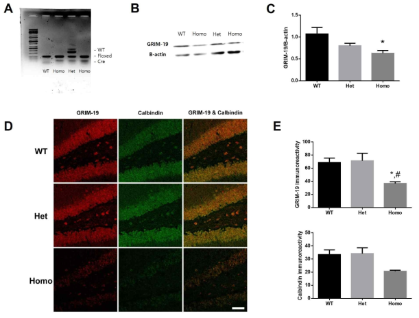 생쥐의 발가락 조직에서 generic cre primer와 GRIM-19 floxed primer를 이용한 PCR 결과(A), 정상 생쥐군(-;Grim19fl/fl, -;Grim19fl/-)과 Hetero군(Camk2α-Cre;Grim19fl/-) 및 Homo군(Camk2α-Cre;Grim19fl/fl)의 해마에서 western blot을 이용한 GRIM-19과 β-actin 단백발현 비교(B), 정상 생쥐군과 Hetero군 및 Homo군의 치아이랑에서의 GRIM-19과 calbindin (성숙 신경세포 표지자)의 형광면역 조직화학 염색 발현 양상 비교(C). one-way ANOVA 분석. 모든 값 평균±SEM