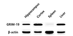 성체 생쥐의 뇌의 피질(cortex), 해마 (hippocampus), 간(liver), 비장(spleen)에서 western blot을 이용한 GRIM-19 단백 발현 비교