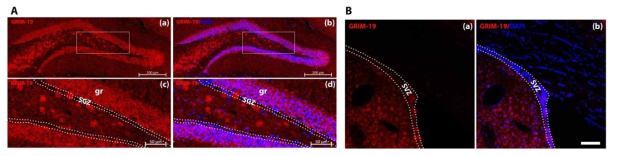 성체 생쥐의 과립세포하층(subgranular zone, SGZ) 및 뇌실하층(subventricular zone, SVZ)에서의 GRIM-19 발현 양상. (A) 치아이랑의 SGZ 부분. (B) SVZ 부분. gr: granule cell layer. scale bar=250 um in (B)