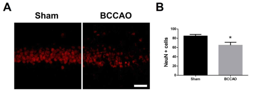 해마의 피라밋세포층에서 양측총경동맥결찰(BCCAO)에 의한 세포사멸을 신경세포 표지자인 NeuN 형광염색으로 확인한 결과(A), 해마의 피라밋세포층에서 NeuN이 나타난 세포 개수를 측정한 그래프(B). t-검정 분석, 모든 값 평균±SEM