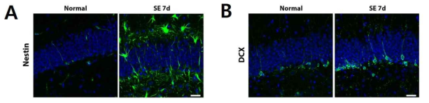 해마의 치아이랑에서 뇌전증중첩증에 의한 성체신경세포생성 증가를 형광염색으로 확인한 결과. (A) Nestin, (B) doublecortin(DCX)