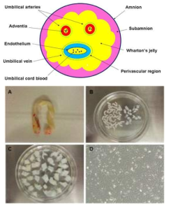 제대 간엽줄기세포는 Wharton’s jelly (노란 부분) 조직에서 분리함. A, 제대; B, 제거된 동맥과 정맥 혈관; C, 분리된 Wharton’s jelly; D, 배양된 제대 간엽줄기세포