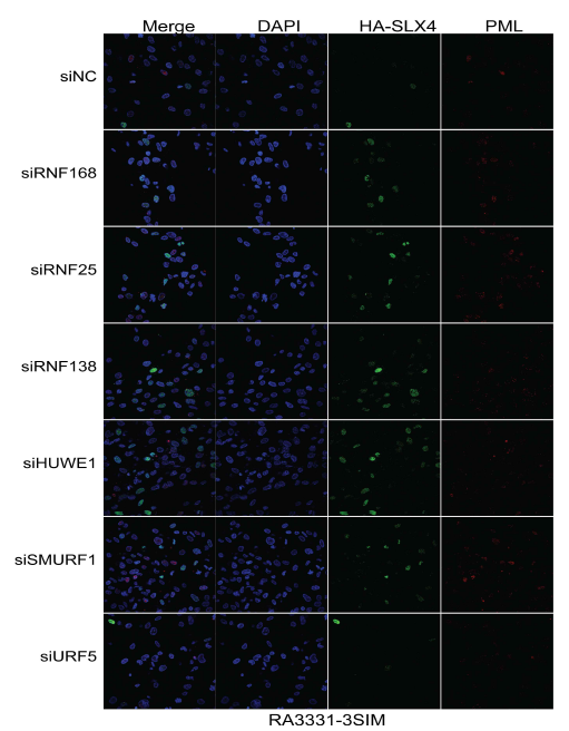 RA3331-3SIM 세포주에서 ubiquitin E3 ligase 발현을 siRNA로 억제하여 SLX4 foci를 IF로 확인