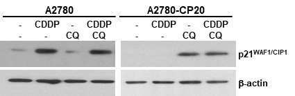 CQ-CDDP combination에 의한 p21WAF/CIP1의 발현 증가