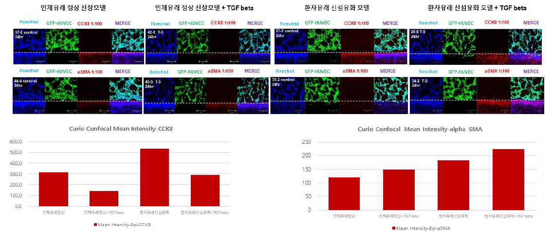 정상신기능 환자 유래 신섬유화 장기칩 및 신부전 환자 유래 신섬유화 장기칩의 TGF beta 자극변화비교