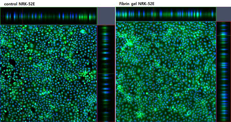 NRK 52의 일반배지와 fibrin gel 위에서 배양 소견