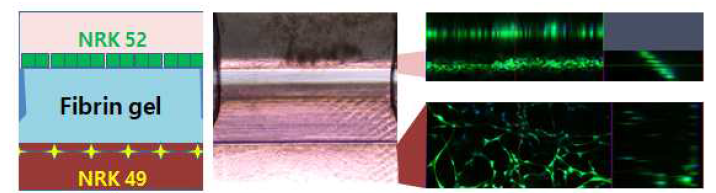 새로운 구조의 장기칩에서 cell-free fibrin gel의 양측면에 NRK 52와 NRK 49의 공배양 소견. 좌측: 장기칩의 구조 모식도, 가운데: 장기칩의 실제 모습, 우측: Live/dead 염색소견