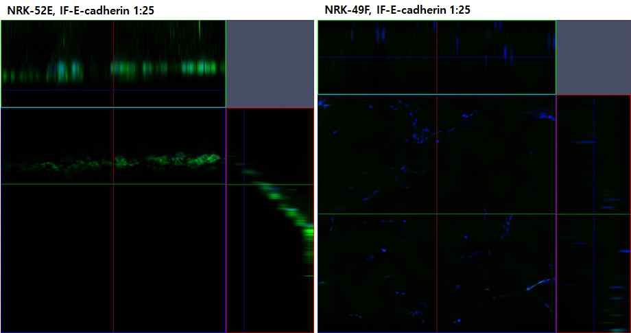 NRK52와 NRK49의 E-cadherin 발현 소견