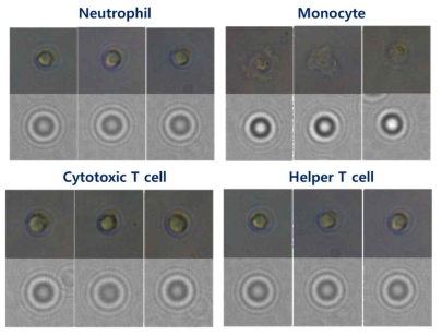 현미경(상)과 Cellytics(하)로 촬영된 특정 백혈구 이미지