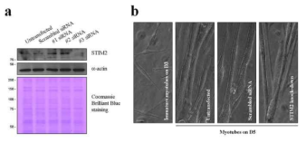 골격근에서 STIM2-결여 세포 모델 제작 및 분화 양상 비교