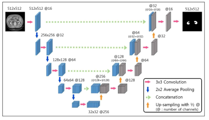 개발된 딥러닝 2D U-net 기반의 신장영역 자동분할 기술의 구조