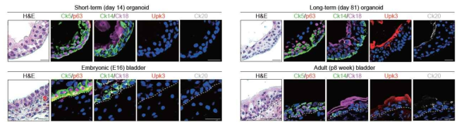 Retinoic acid를 처리한 방광 오가노이드. 방광 줄기세포의 분화를 통해 ketrain이 방광 오가노이드 lumen에 축적됨을 확인함. 완전 분화를 통해 방광 줄기세포 (Ck5, red) 마커가 basal 위치에 발현되고 intermediate 세포 (double negative)가 우산세포와 줄기세포 사이에 존재함을 확인