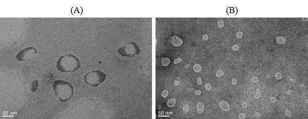 (A) CORM-2-SLNs 및 (B) CORM-2-UDLs의 투과전자현미경 사진
