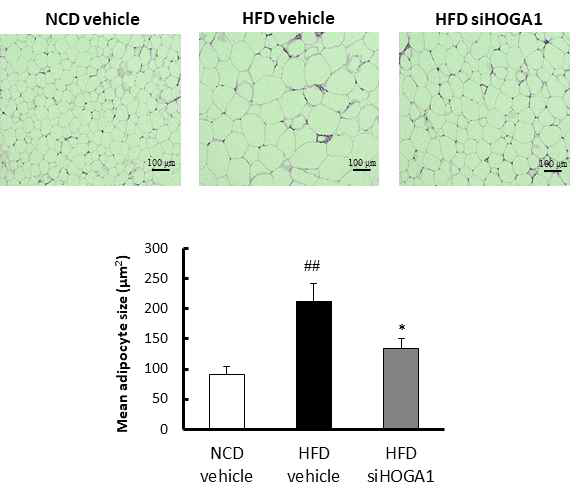 고지방식이 마우스의 지방세포 사이즈에 미치는 Hoga1 siRNA 처리 효과
