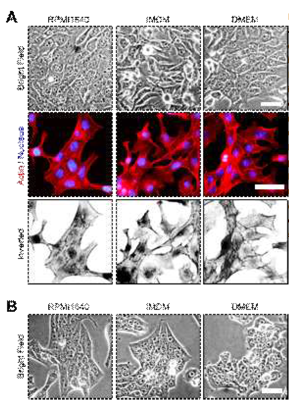 Cell Scattering and Morphological Drift of 4T1Cells during Culture in Three Media Types (A) Phase contrast images after 6-week culture of 4T1 ineach media RPMI1640, IMDM and DMEM. In 4T1 of IMDM, loss of cell-cell contactis noticeable point found in entire cell culture. On the other hand, 4T1 ofRPMI1640 and 4T1 of DMEM maintained the morphology of original 4T1(data notshown). Picture of upper panels are phase contrast images of 4T1. Middle panelsare 4T1 cells which are stained with phalloidin for actin (red) and DAPI fornucleus (blue). Lower panels are inverted images of actin and nucleus stain.Scale bar = 50μm. (B) Phase contrast images after 6-week culture of4T1-EpiKD in three different media. Scale bar = 50μm