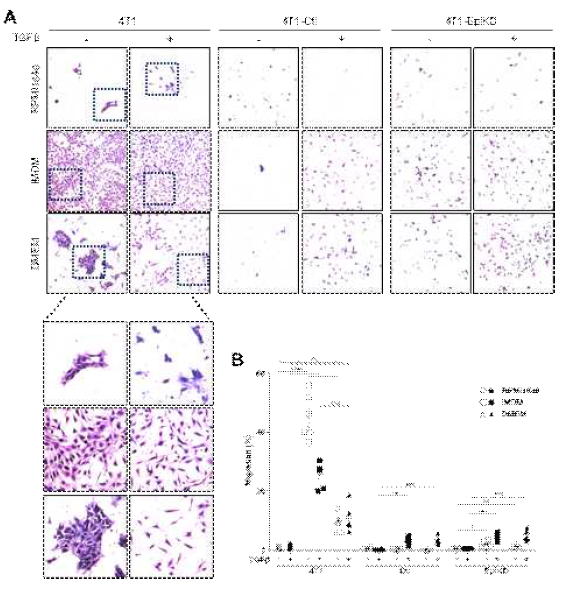 Variation of Transwell Migration upon MediaComponent and Epithin/PRSS14 Shedding (A and B) Transwell migration assay of 4T1, 4T1-Ctl and4T1-EpiKD cells that are grown in RPMI1640, IMDM or DMEM with or without TGFβ after two-day incubation. Hematoxylin stained migrated cells wereobserved significantly in 4T1 of IMDM than other media, and TGFβ treated control than negative. 4T1 cells with dashed box were enlargedbelow to compare scattering by TGFβ. Quantified migration through threedifferent fields with duplicates was calculated as a graph in B. Data arepresented as mean ± SEM. Statistical significance was performed between twodifferent media. * p<0.05; ** p<0.01; *** p<0.001;, **** p<0.0001(Student’s t-test)