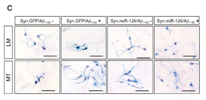 AD 모델생쥐 뇌조직으로부터 분리 배양된 세포모델에서 miR126 효과