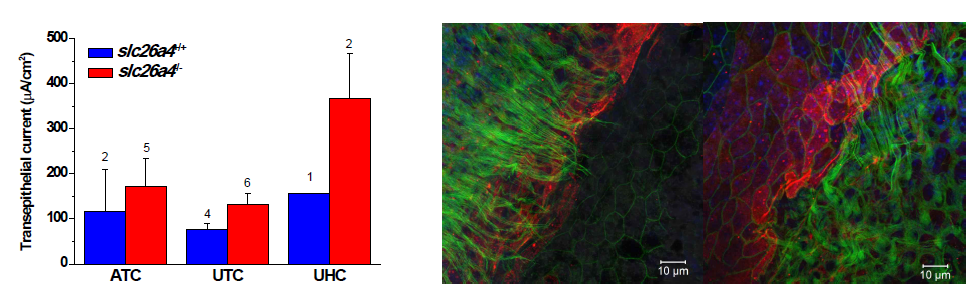 slc26a4-/- 마우스에서 p2rx2 기능 및 발현의 증가. ATP에 의해 유도되는 양이온 이동전류가 slc26a4-/- 마우스에서 slc26a4+/+에 비해 현저히 증가할 뿐만 아니라 (좌측) 해당 단백의 발현도 증가함 (중간: slc26a4+/+ 마우스, 우측: slc26a4-/- 마우스)