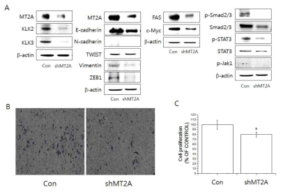 MT-2A knockdown LNCap-LN3 세포주의 전립선암 증식 및 전이에 대한 영향 조사. (A)웨스턴 블롯 (B) Migration assay (C) 세포증식