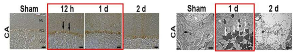 (좌) 심정지 후 소뇌에서 자가포식성 사멸 인자(LC3) 면역염색 결과 (우) 전자현미경 사진
