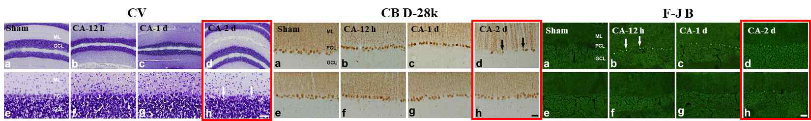 심정지 후 소뇌에서 CV, CB D-28k, F-J B 염색 결과