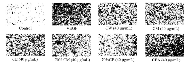 Effect of Cultivated Orostachy Japonicus extracts on VEGF-induced chemotactic invasion in HUVEC. After incubation for 16 h, migrated cells through the trans-well membrane was photographed (magnification, ×200)