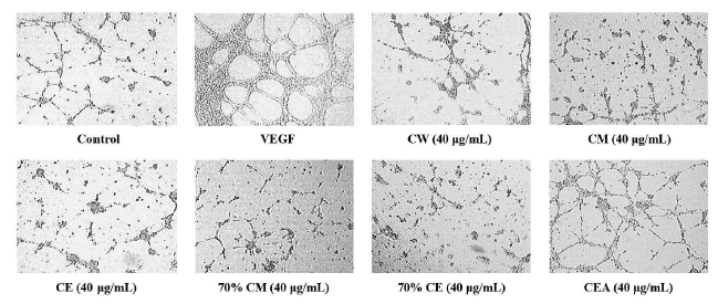 Effect of Cultivated Orostachy Japonicus extracts on VEGF-induced chemotactic invasion in HUVEC. After incubation on matrigel for 12 h, capillary structure formation of endothelial cells was photographed (magnification, ×200)