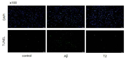 Tellimagrandin에 의한 Amyloid-βpeptide 처리 동물모델에서의 neuronal cell damage 억제 효과