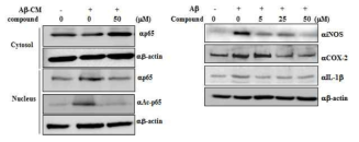 히스톤 아세틸화 억제에 의한 microglia cell의 NF-kB acetylation 및 염증 반응 억제