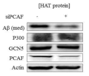 HAT 단백질 발현에 따른 Aβpeptide 생성 조절