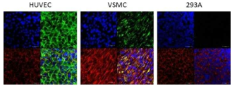 SPP1 expression in endothelial cells (Left; CD31) and smooth muscle cells (Right; aSMC)