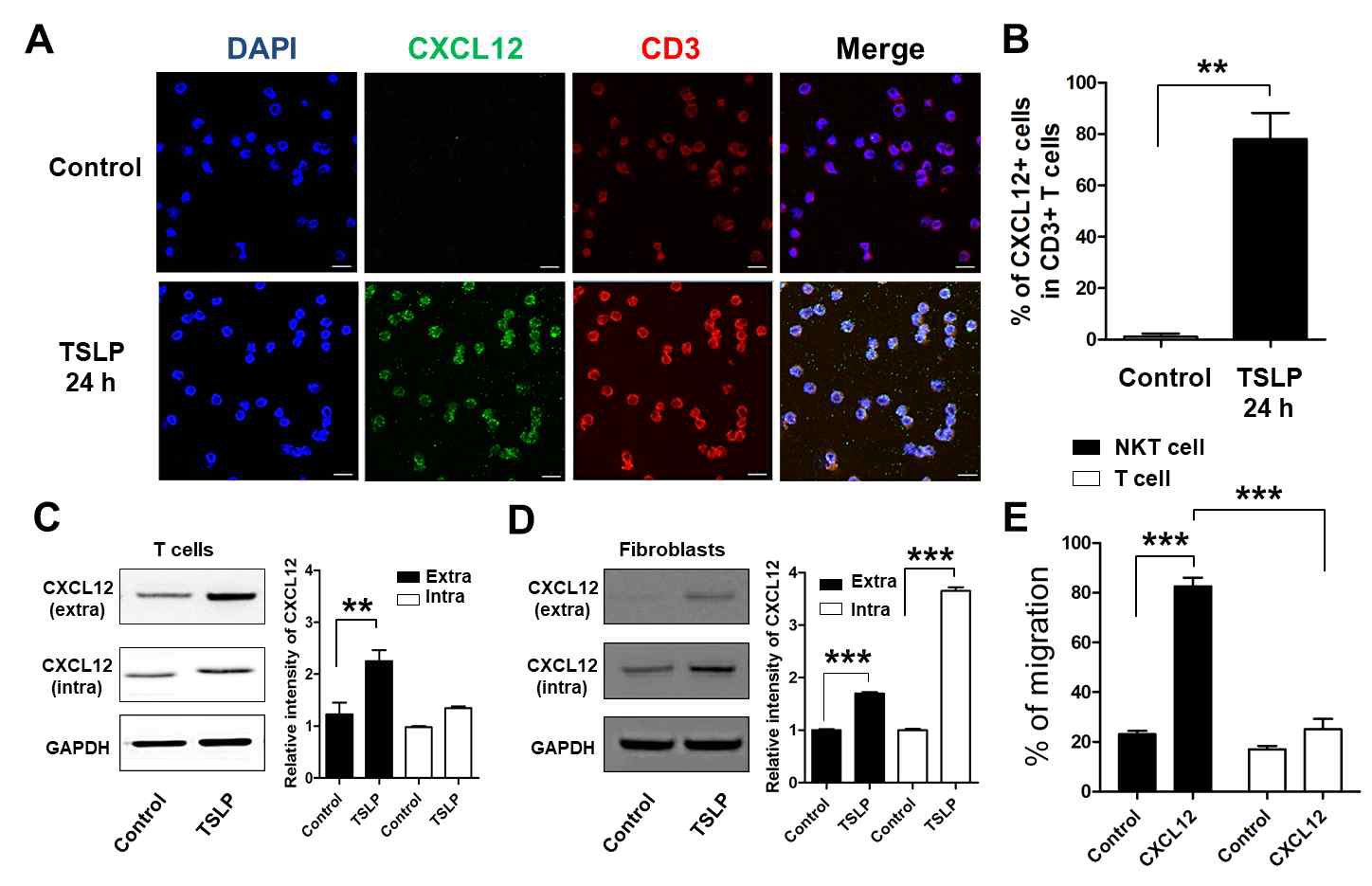 T 세포에서 관련 조절 인자 검증 (A) CD3+ T 세포에 TSLP 처리 유무에 따른 CXCL12 발현 비교 면역형광염색 이미지 (B) 면역형광 염색 이미지의 수치화 그래프 (C) CD3 T 세포 및 세포배양액에서의 CXCL12 확인 (D) Fibroblast 및 세포배양액에서의 CXCL12 확인 (E) NKT 세포와 T 세포의 CXCL12에 의한 migration 확인