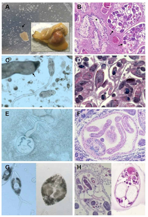 Photographs of the infection by three different types of Cercaria in the Manila clam. (A) A Cercaria-infected clam demonstrating the reddish body and a numerous number of sporocysts (arrow) collected from a part of infected clam after being cut into pieces; (B) Sporocysts containing Parvatrema duboisi in cercaria stage (arrows), and early developing eggs in the female follicle (*). (C) Alive Cercaria tapidis with eye spots and suckers; (D) Histology section of Cercaria tapidis (H (E-F) Cercaria pectinata (=Bacciger bacciger) with setae on the tail. (G-H) Cercaria (left), and metacercaria stage (right) of P. duboisi in the Manila clam