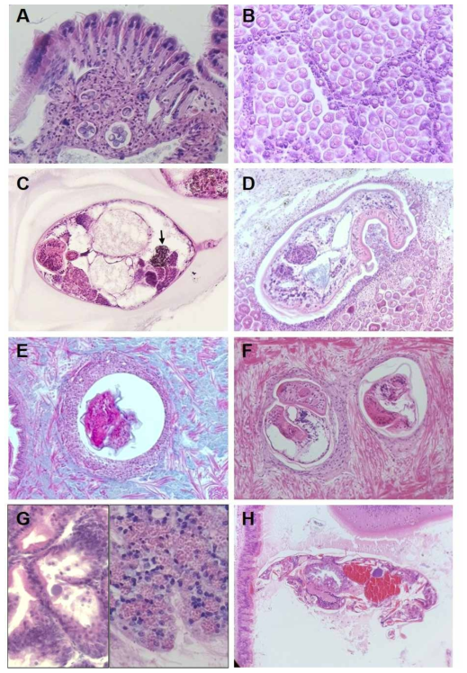 Micrographs of parasitic micro-organisms in the several marine mollusk hosts inhabiting in the Korean waters (H (B) Marteilioides chungmuensis in the gonad follicle of the Pacific oyster; (C) Hyper-parasitic Urosporidium sp. (arrow) in the metacercaria Parvatrema duboisi infecting the Manila clam; (D) Gymnophalloides seoi found in the gonad of the Pacific oyster; (E) Encysted metacercaria Himasthla alincia in the foot of Manila clam; (F) Unidentified encysted metacercaria in the foot tissue of Cyclina sinensis; (G) Basophilic Rickettsia-Like Organism (RLO), and Eosinophilic RLO (right) infecting the Pacific oyster; (H) Symbiotic copepoda found in the stomach of Mytilus edulis galloprovincialis
