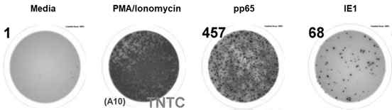 CMV specific IFN gamma ELISPOT