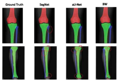 Examples of bone segmentation results
