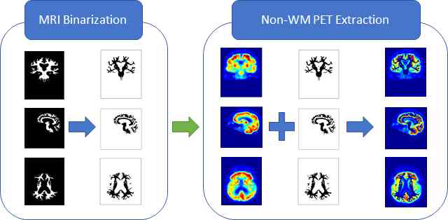 Non-White Matter 추출