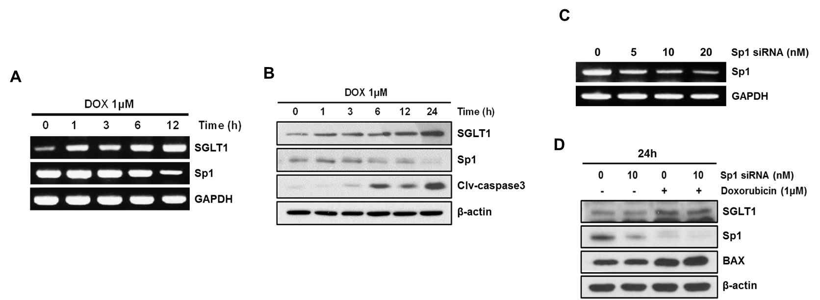 Doxorubicin을 처리한 심근세포에서 Sp1의 발현 변화와 Sp1 siRNA 처리 효과