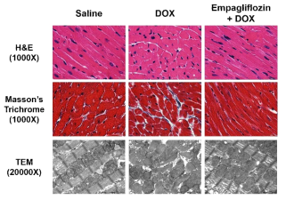 Doxorubicin으로 유도된 심근 손상 동물 모델에서 empagliflozin의 심근 조직에 대한 효과
