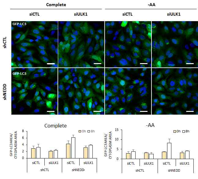 NEDD4L결핍시 증가된 autophagy활성의 ULK1 Knockdown에 의한 감소현상